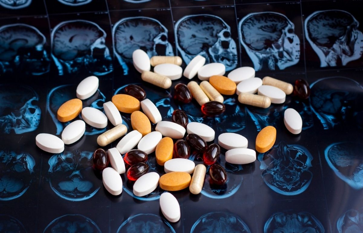 Understanding How Addiction Impacts the Brain